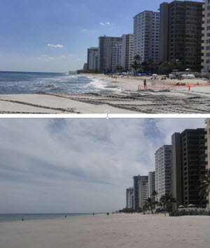 Beach at Galt Ocean Mile in Fort Lauderdale before (top) and after completion of beach renourishment project.  